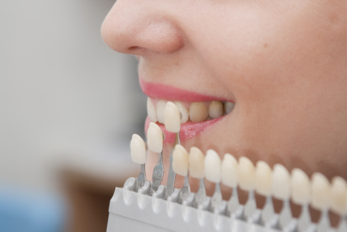 Dental La mesa Dental teeth